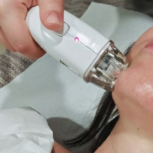 Scopri di più sull'articolo ESM BEAUTY PLUS KUBE