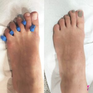 Scopri di piรน sull'articolo Pedicure Semipermanente
