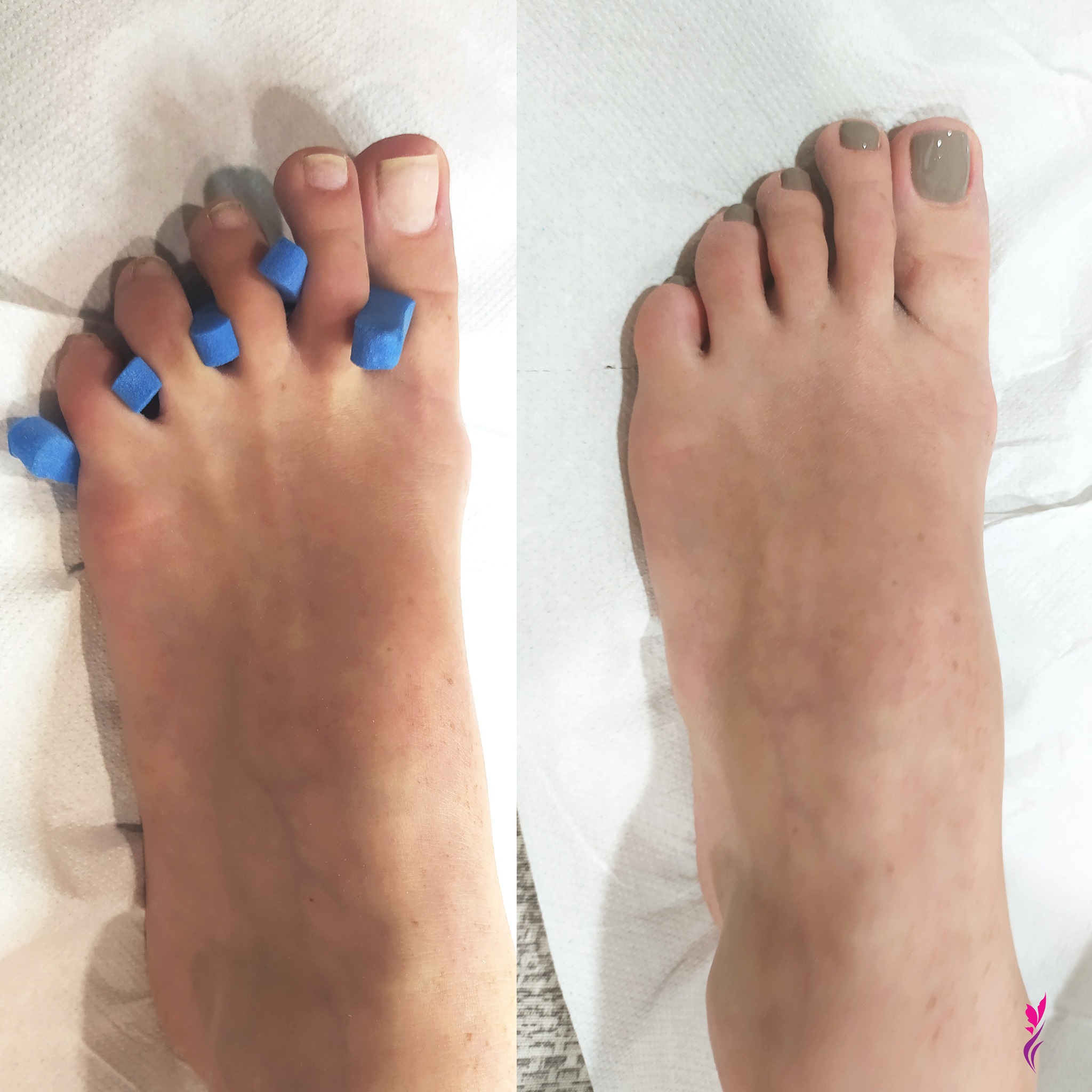 Al momento stai visualizzando Pedicure Semipermanente